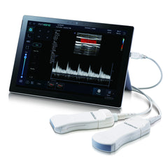 Alpinion MiniSono Tablet Ultrasound System