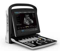 Chison Eco 3 Portable BW Ultrasound Unit