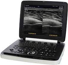 Samsung HM70 EVO Premium Portable Ultrasound Unit